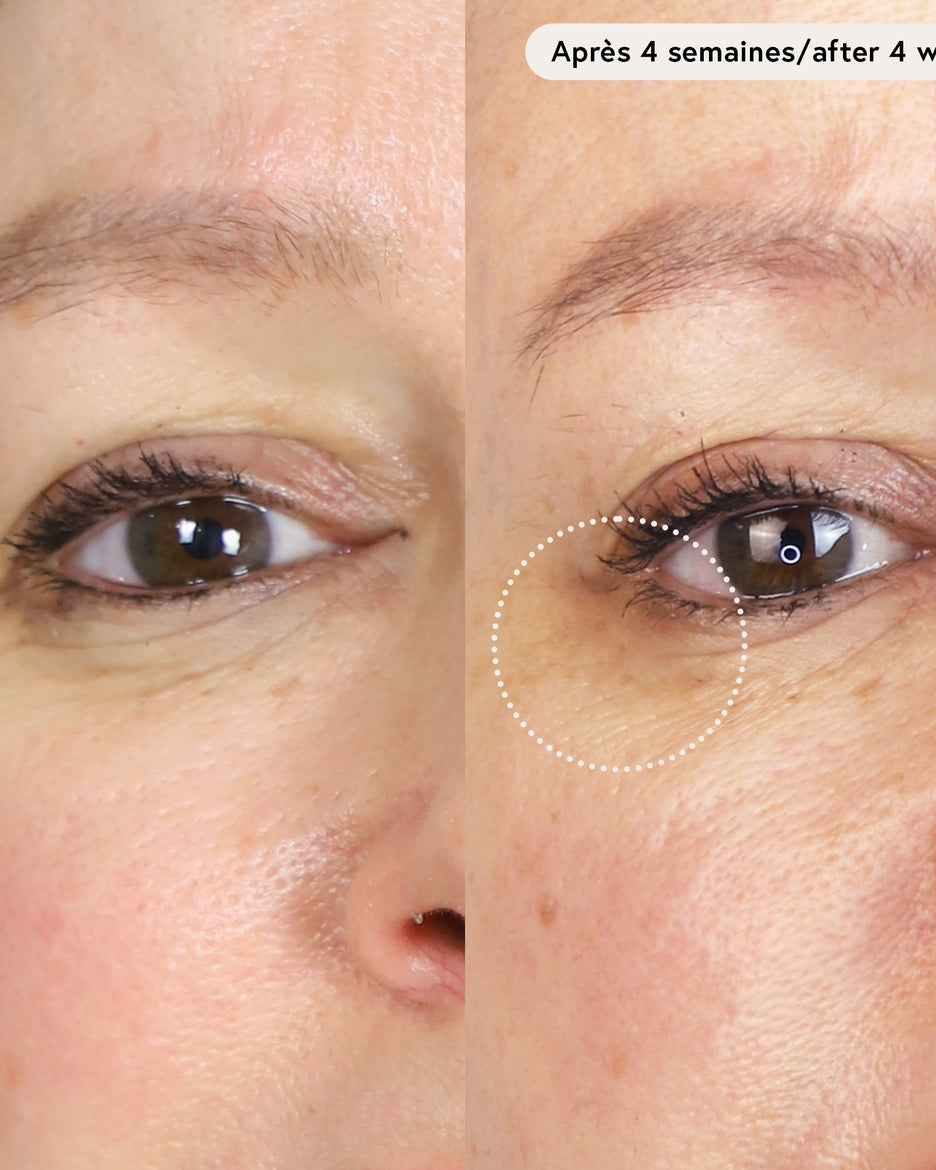 Le Masque du Temps Redensifiant