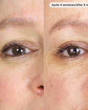 Le Masque du Temps Redensifiant