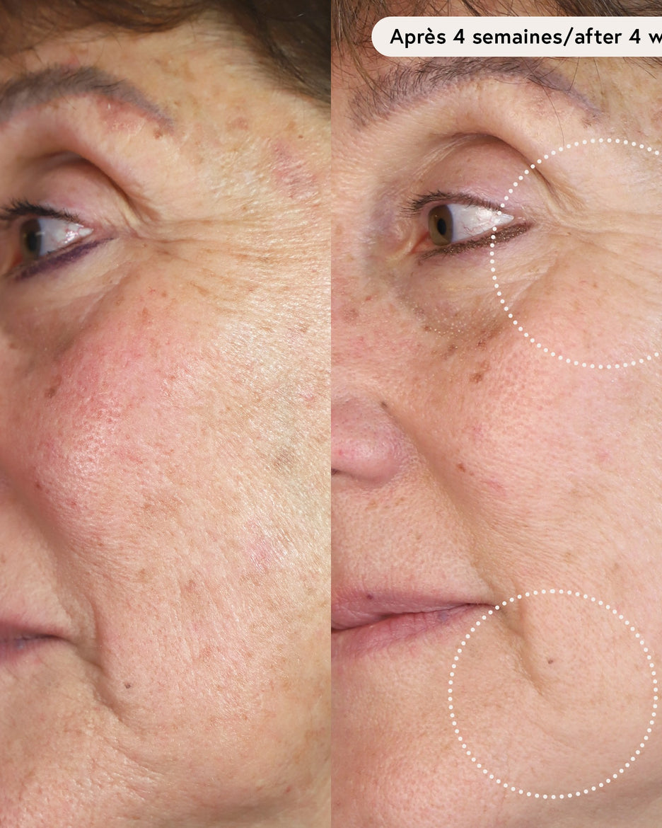 Le Masque du Temps Redensifiant