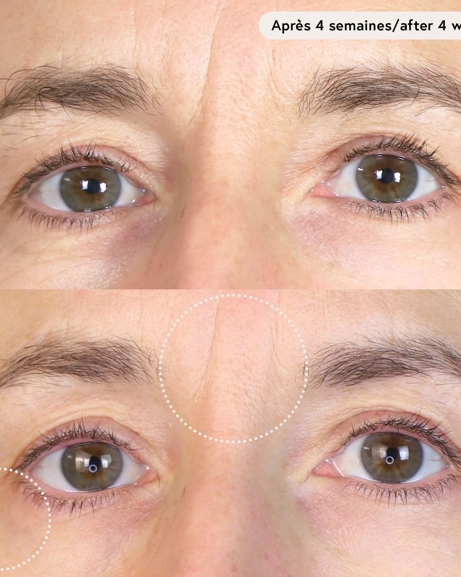 Le Masque du Temps Redensifiant