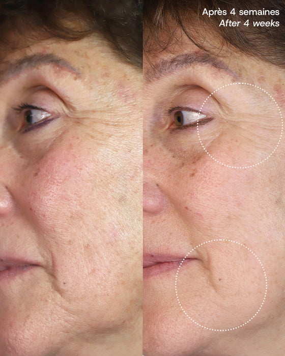 Le Masque du Temps Redensifiant