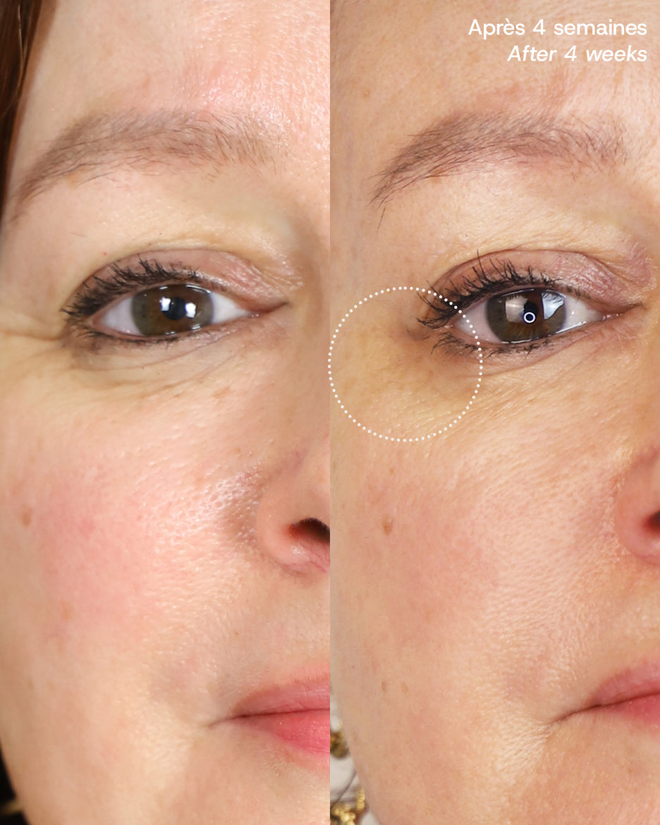 Le Masque du Temps Redensifiant