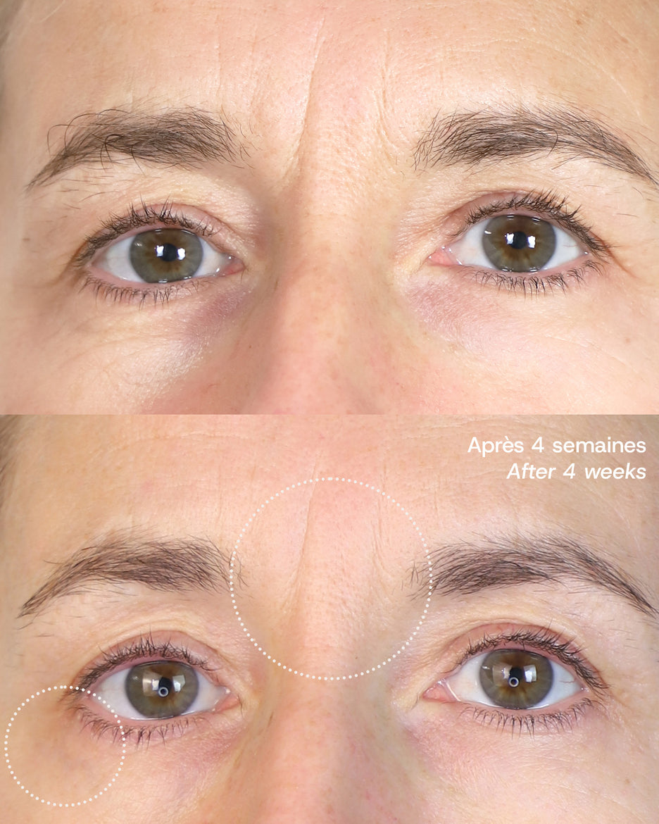 Le Masque du Temps Redensifiant