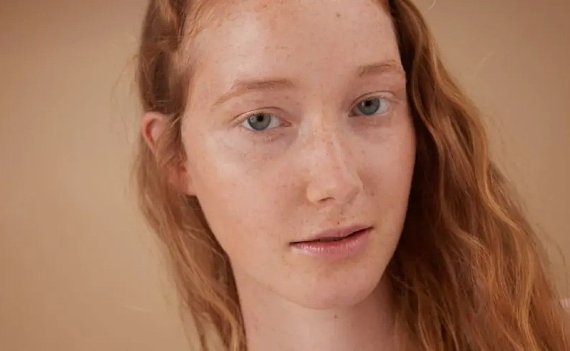 Comment atténuer les rougeurs sur le visage ?