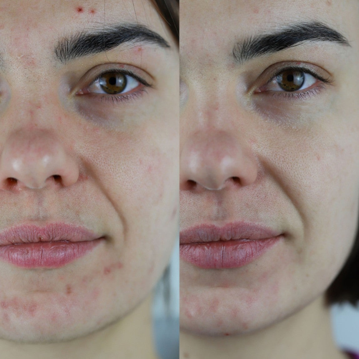 PAX, huile visage au CBD : avant/après