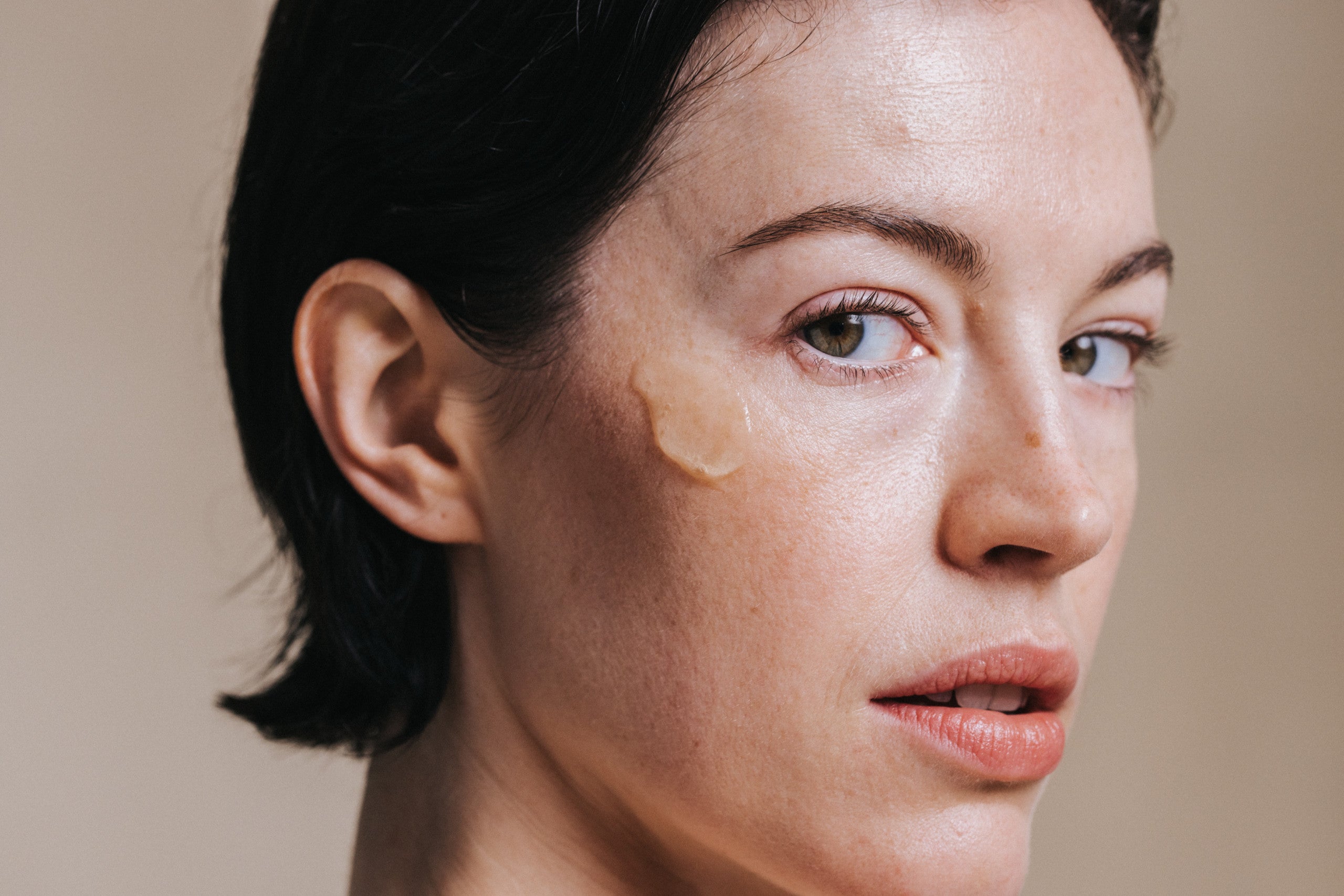 Comment atténuer les taches pigmentaires ?