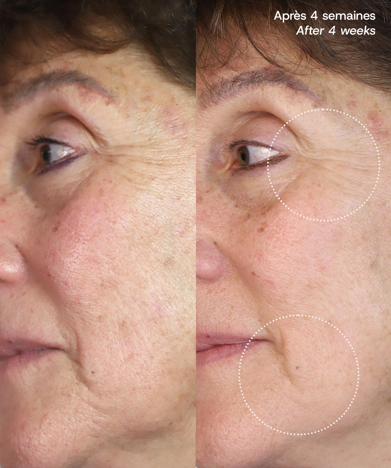 Le Masque du Temps Redensifiant