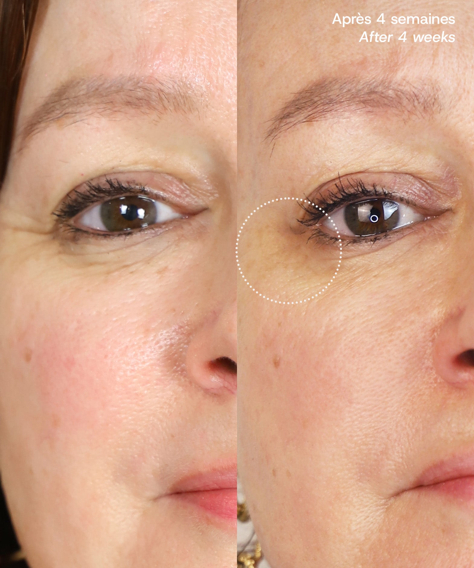 Le Masque du Temps Redensifiant