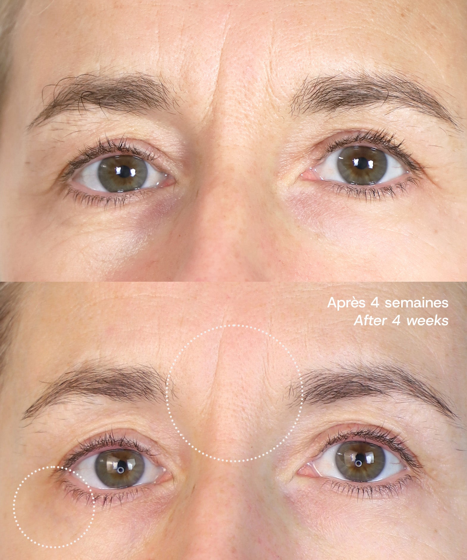 Le Masque du Temps Redensifiant