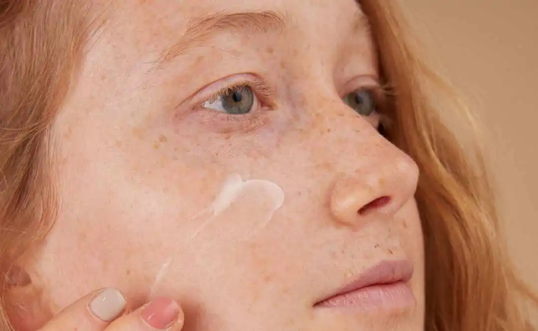 Quelles huiles visage contre l’acné ?