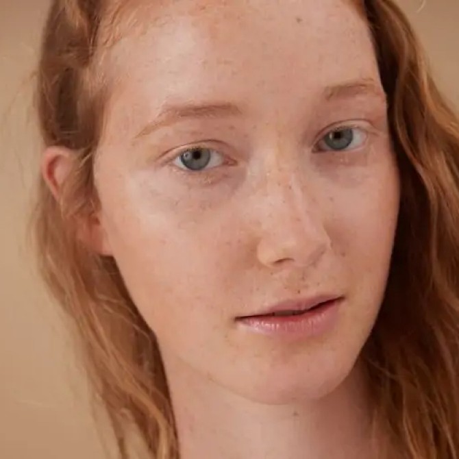 Comment atténuer les rougeurs sur le visage ?